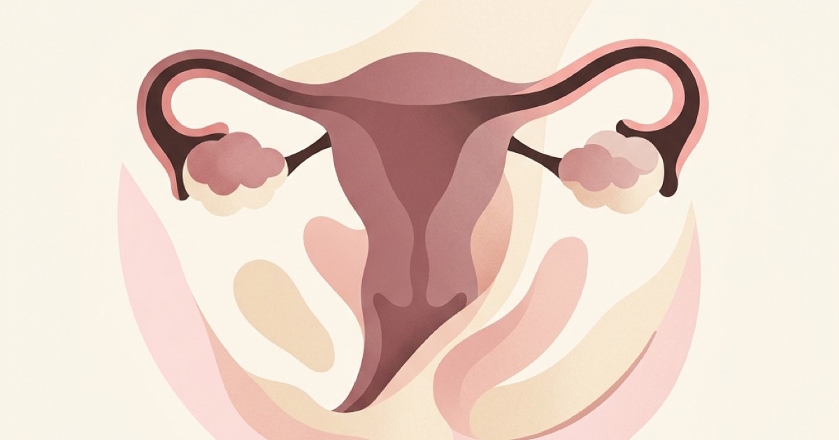 What Is Endometriosis? Symptoms, Stages & Causes